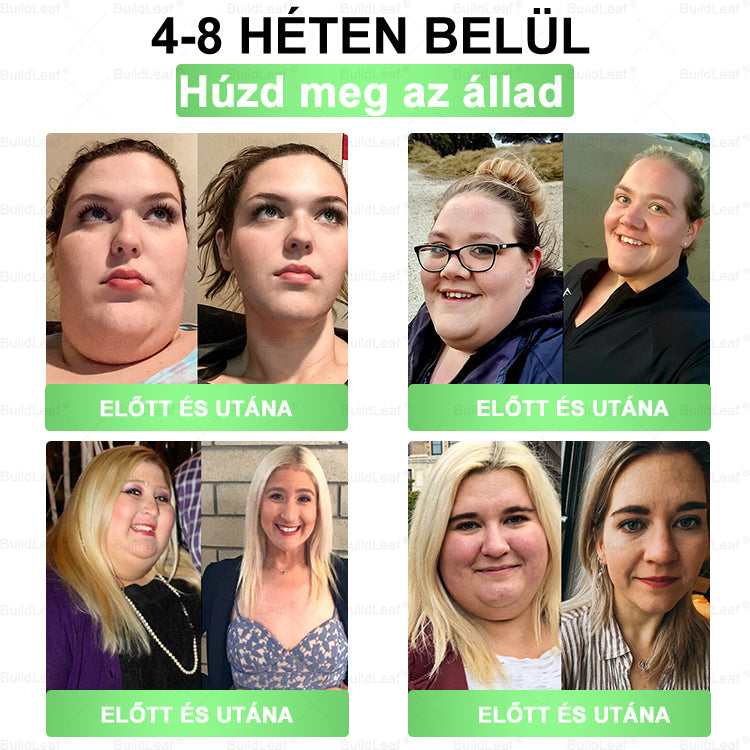 đ„UtolsĂł 5 darab â 50% kedvezmĂ©ny! đż A kĂ©szlet vĂ©ges! Szerezd be MOST a BuildLeafÂź cseppeket, Ă©s Ă©lvezd a gyors fogyĂĄst fĂ©lĂĄron! đȘ