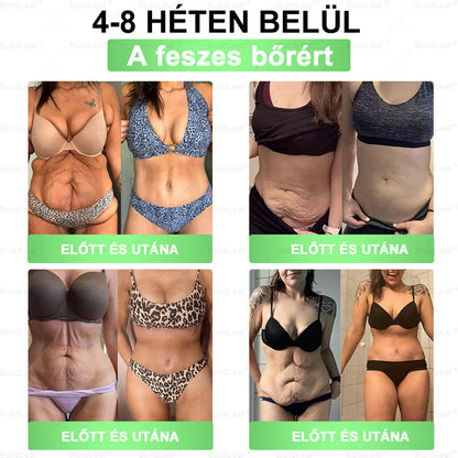 𝐁𝐮𝐢𝐥𝐝𝐋𝐞𝐚𝐟® 𝐆𝐋𝐏-𝟏 𝟖-𝐢𝐧-𝟏 𝐒𝐥𝐢𝐦 & 𝐇𝐞𝐚𝐥𝐭𝐡𝐲 𝐎𝐫á𝐥𝐢𝐬 𝐌𝐞𝐠𝐨𝐥𝐝á𝐬 ✅ 𝐓á𝐦𝐨𝐠𝐚𝐭𝐣𝐚 𝐚𝐳 𝐞𝐥𝐡í𝐳á𝐬 𝐤𝐞𝐳𝐞𝐥é𝐬é𝐭, 𝐚 𝐬𝐳í𝐯- é𝐬 é𝐫𝐫𝐞𝐧𝐝𝐬𝐳𝐞𝐫𝐢 𝐞𝐠é𝐬𝐳𝐬é𝐠𝐞𝐭, 𝐚 𝐜𝐮𝐤𝐨𝐫𝐛𝐞𝐭𝐞𝐠𝐬é𝐠𝐞𝐭, 𝐚𝐳 𝐚𝐥𝐯á𝐬𝐢 𝐚𝐩𝐧𝐨é𝐭, 𝐚 𝐛é𝐥𝐫𝐞𝐧𝐝𝐬𝐳𝐞𝐫 𝐞𝐠é𝐬𝐳𝐬é𝐠é𝐭, 𝐦𝐢𝐤ö𝐳𝐛𝐞𝐧 𝐟𝐞𝐬𝐳𝐞𝐬í𝐭𝐢 𝐚 𝐛ő𝐫𝐭 é𝐬 𝐧ö𝐯𝐞𝐥𝐢 𝐚𝐳 𝐞𝐧𝐞𝐫𝐠𝐢á𝐭.